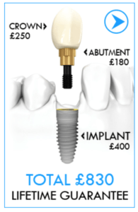 Kreativ Dental's implant fee
