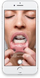 ToothPic users are guided through clinical selfies that OralEye dentists examine